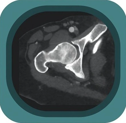 CT hip anatomy icon